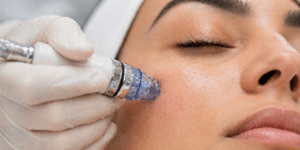 hydrafacial